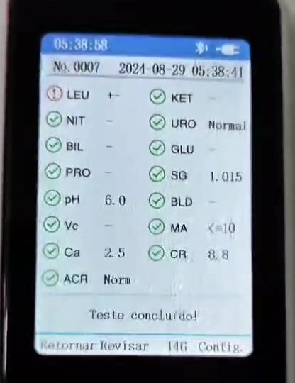 Tela de resultado do UC-32B VET com tira 14G: microalbumina, creatinina, cálcio e ACR