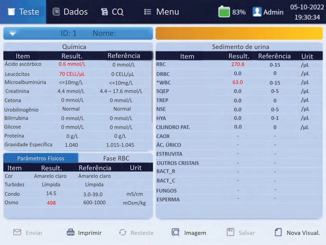 Tela de resultados do US-500